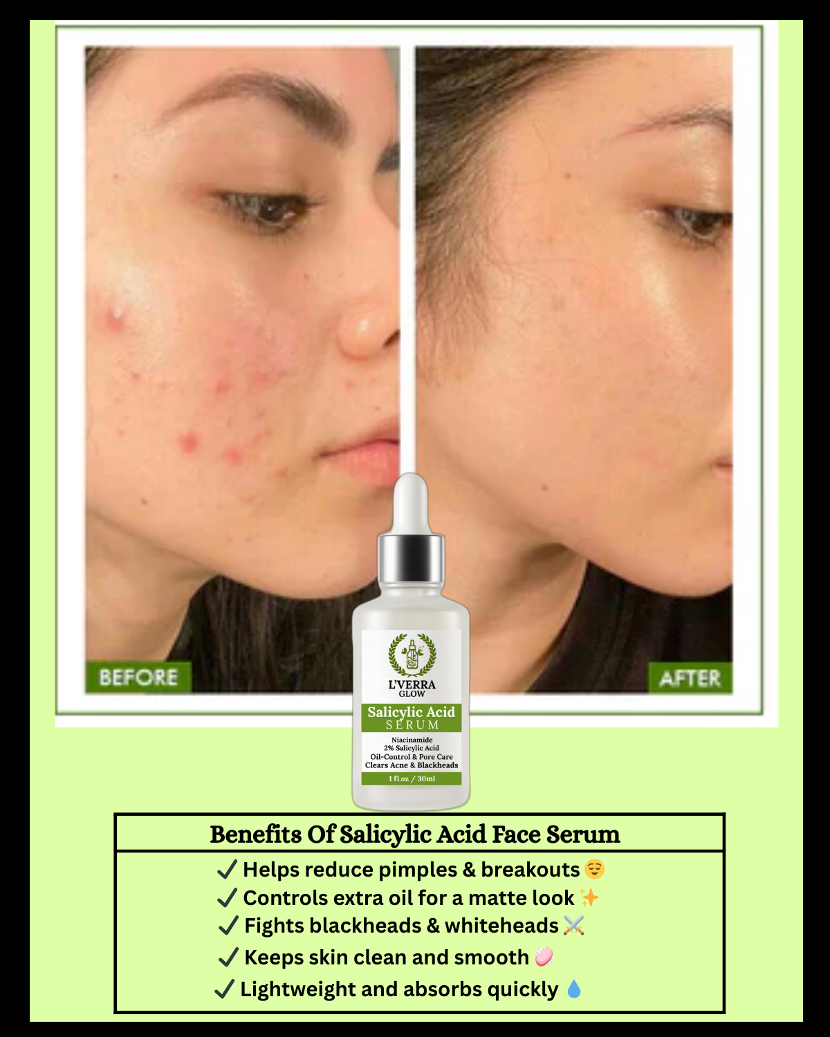 Salicylic Acid Serum